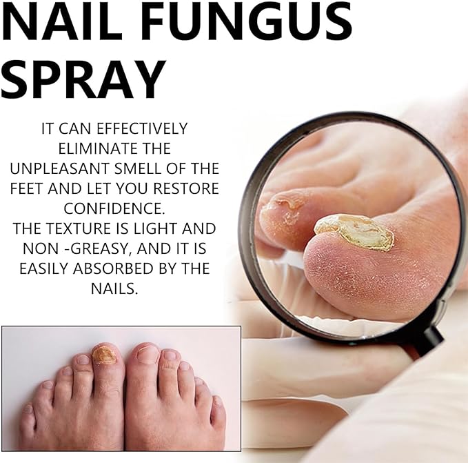 NAIL FANGUS SPRAY
