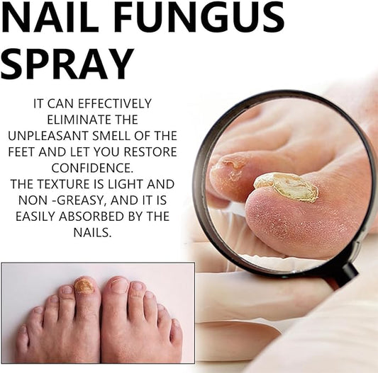 NAIL FANGUS SPRAY